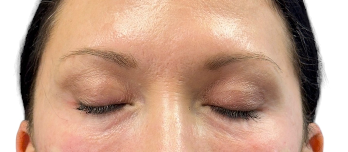 Before After Under Eye Ez Gel 1